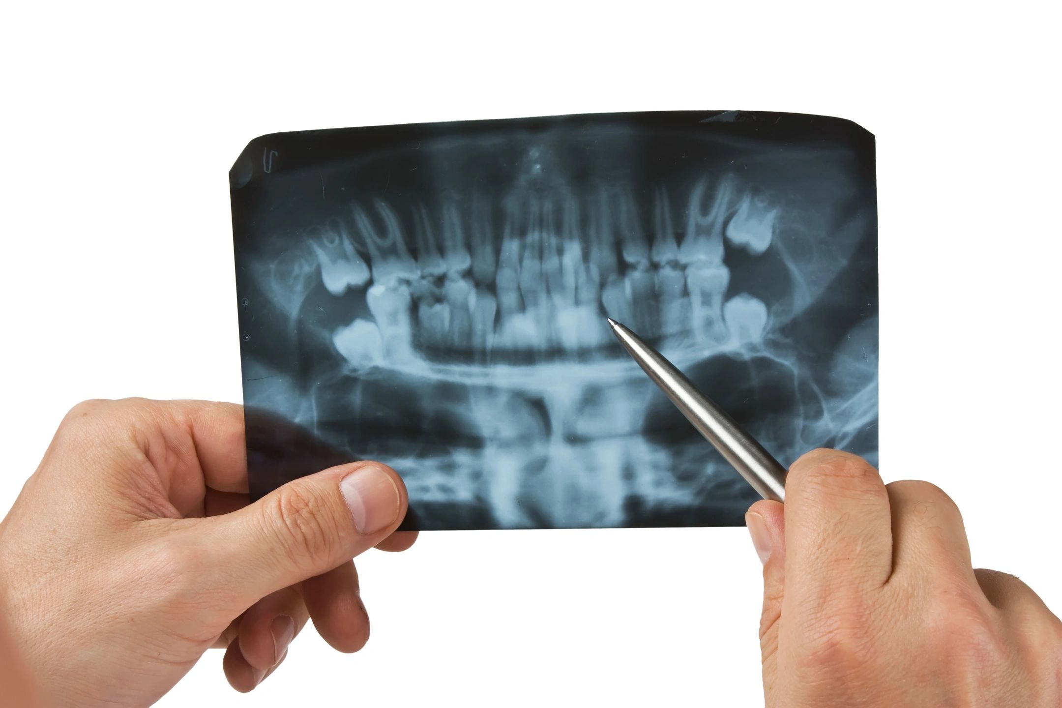 Implant repair